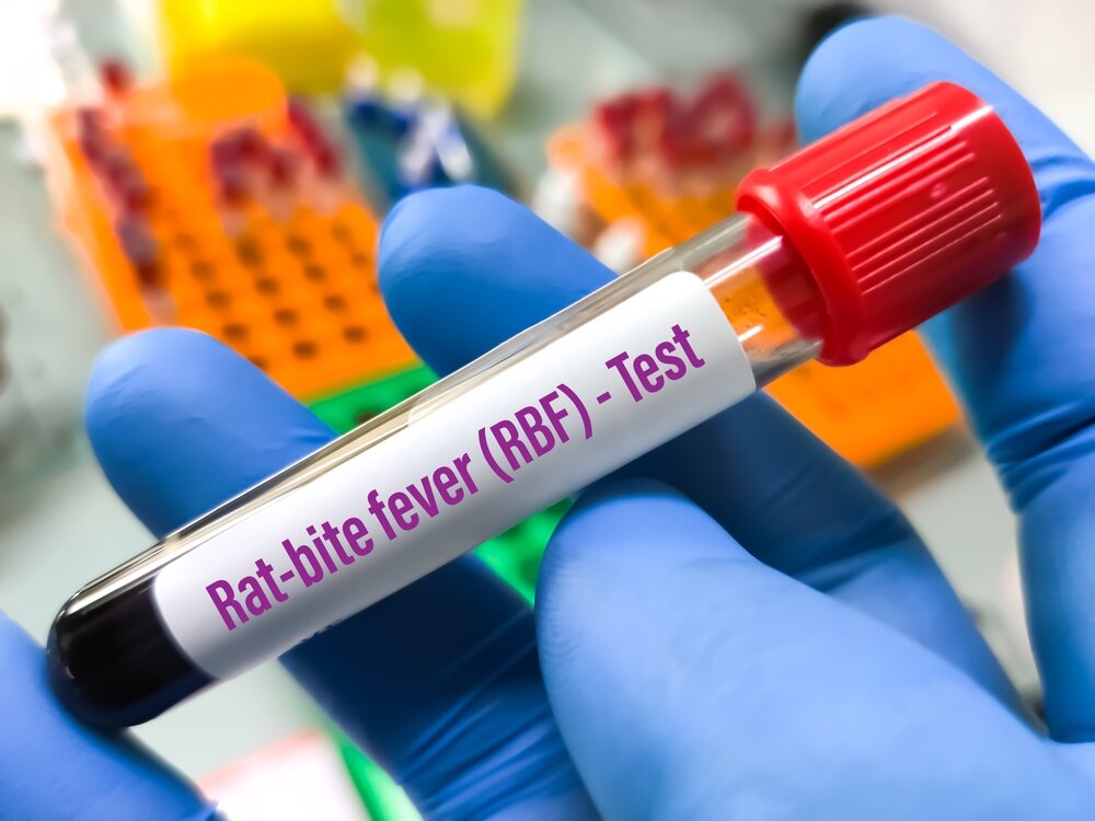 Rat Removal. Rat bite blood sample.