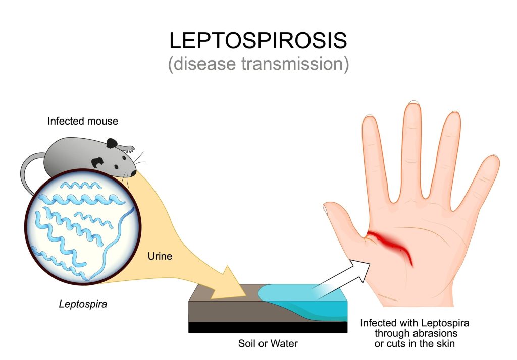 Image of leptospirosis disease. Concept.